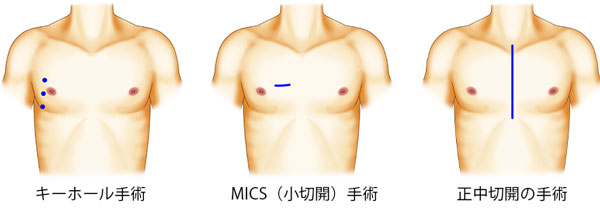 傷口のイメージ